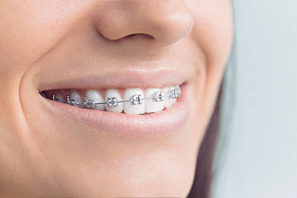 Best Invisalign and Clear Aligners  in Norton, OH